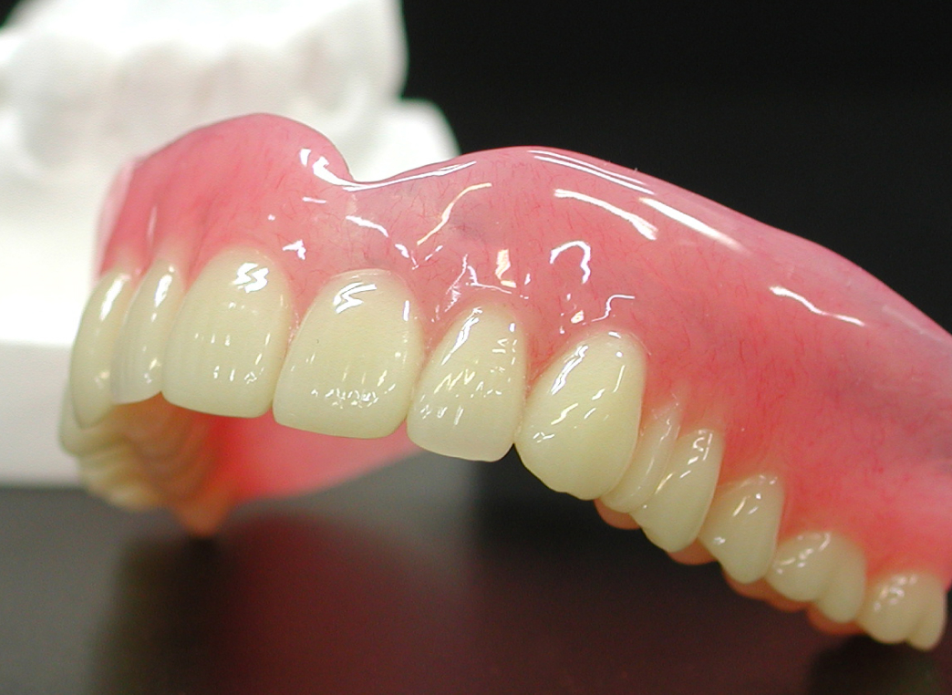 入れ歯（義歯）