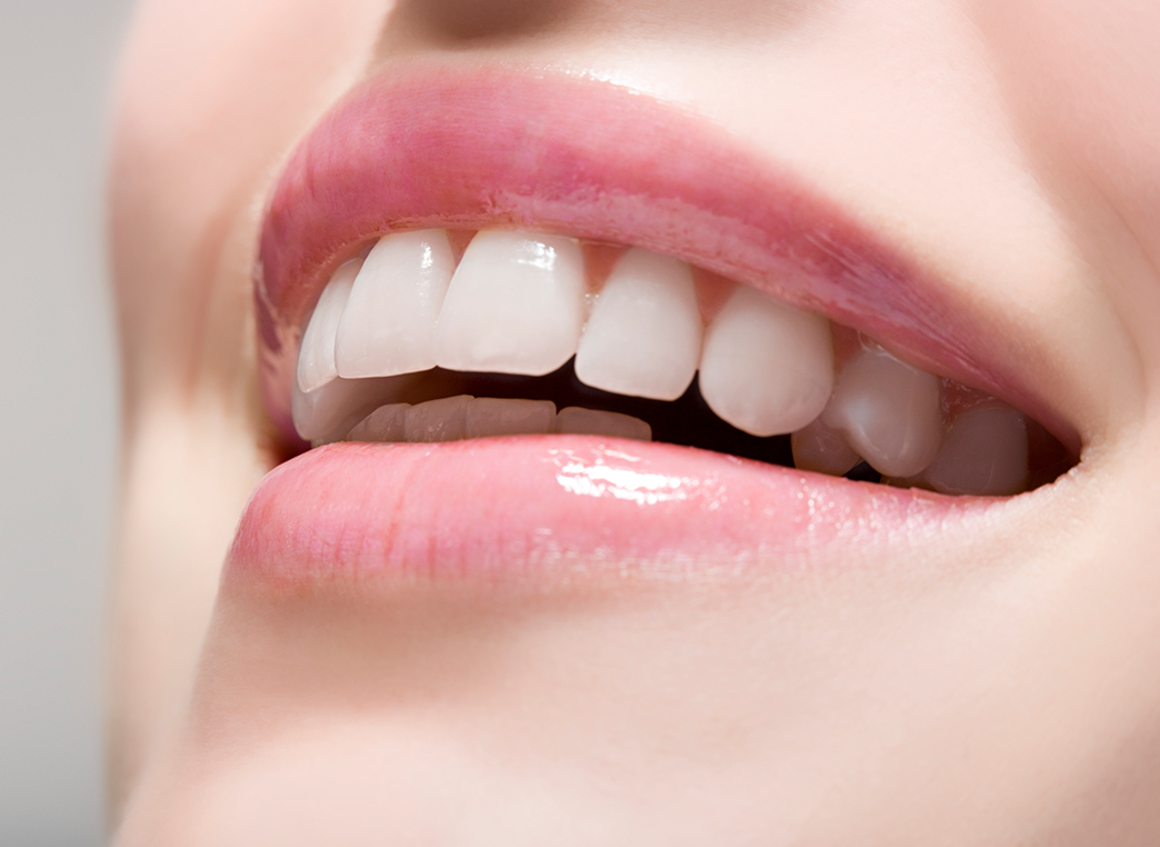 ホワイトニング